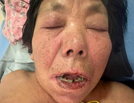 A person with broken teeth

AI-generated content may be incorrect.